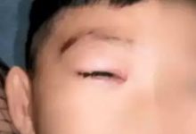 6岁男童被狗咬，狂犬疫苗没打完就去世，真相让人痛惜-知道了吗？